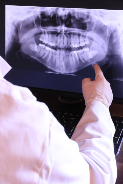 Best Emergency Treatment for Dental Infections or Abscesses in South Deerfield, MA